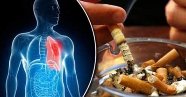 دراسة تؤكد المدخنون أكثر عرضه للإصابة بفيروس كورونا