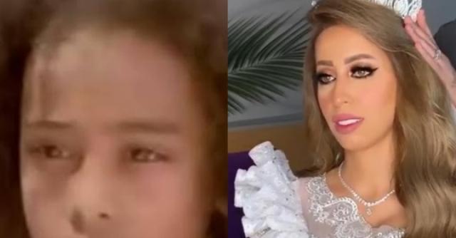 م كيفي عزيز بعد مرور 15 عاما.. شاهد شكل الطفلة سوكا في حفل زفافها | أخبار فنية
